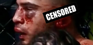 UFC: Σοκαριστικός τραυματισμός για τον Brahimaj -Κόντεψε να χάσει το αυτί του από αγκώνα UFC: Σοκαριστικός τραυματισμός για τον Brahimaj