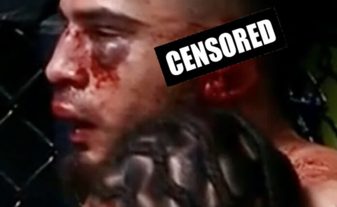 UFC: Σοκαριστικός τραυματισμός για τον Brahimaj